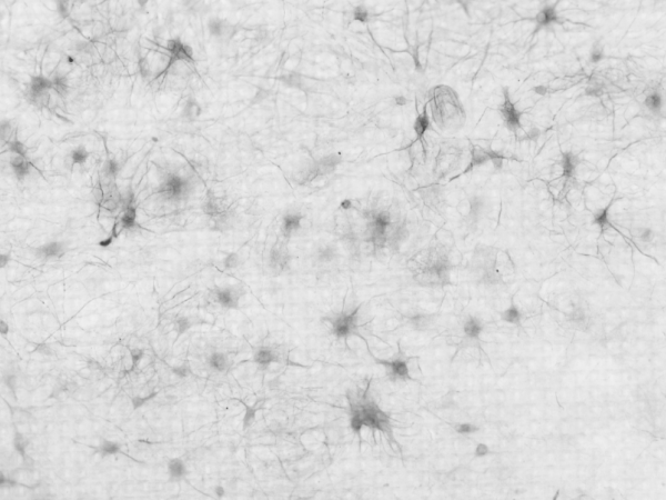 Neuronen maken kabaal
