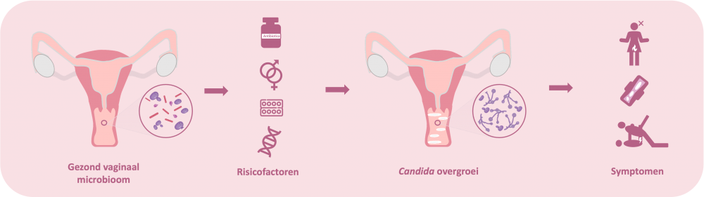 Het gezonde vaginale microbioom, de risico factoren voor het ontwikkelen van een vaginale schimmelinfectie en de bijhorende symptomen.