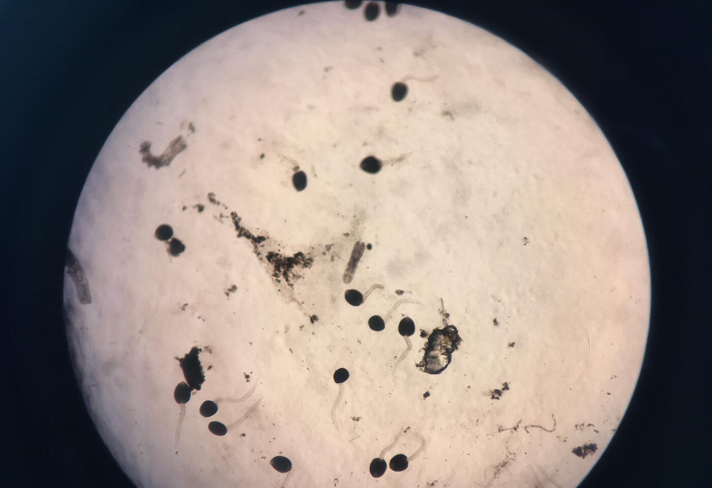 beeld onder microscoop